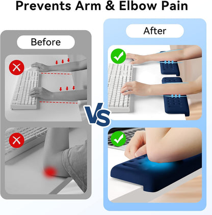 Sushret L-Shaped Desk Elbow Pad for Desk, 2-Pack Memory Foam Elbow Rest for Desk Edge Cushion, Non-Slip Ergonomic Arm Rest for Wrist, Palm & Forearm Support, Office Home, Separate Design, Black