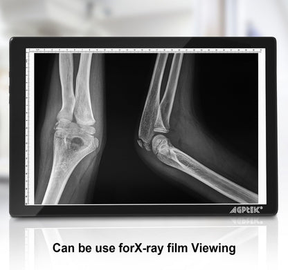 Light Box,Magnetic A4 Light Pad LED Tracing Light Board Physical Buttons Control USB Powered Ultra-thin Dimmable Brightness for Diamond Painting Tatoo Pad Animation,Sketching,Stencilling X-ray Viewing